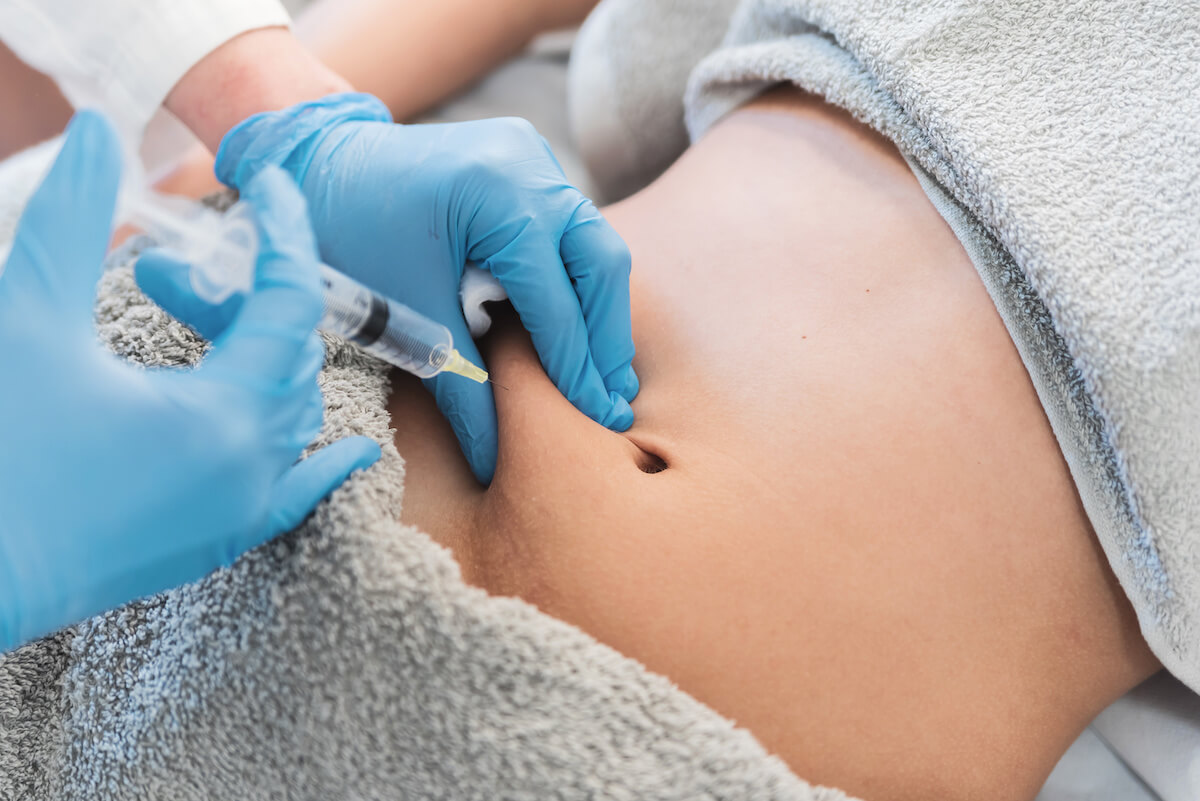 injections to remove fat from abdomen